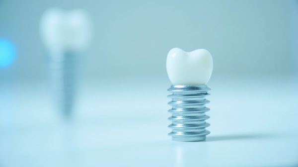 Comprendre le succès des implants dentaires en Turquie